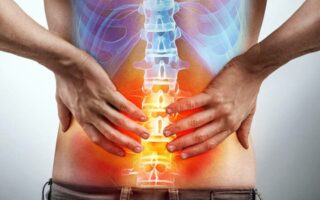 lumbalgia radiografía