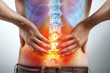lumbalgia radiografía