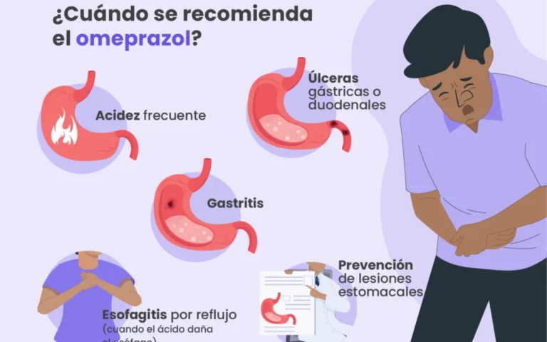 infografia de reflujo