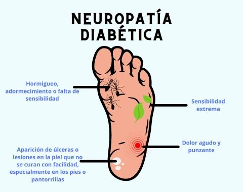 neuropatía diabética